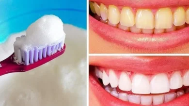 As 10 melhores receitas caseiras para clarear naturalmente os dentes amarelados