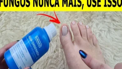 Nunca mais tive fungos e micose nas unhas depois que usei essa receita