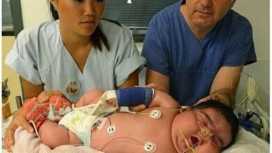 Mulher com 250 Kg dá à luz bebê de mais de 15Kg f