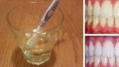 Clareamento dental caseiro de vinagre de maçã