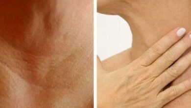 4 Tratamentos naturais para prevenir o surgimento de rugas no pescoço e nas mãos