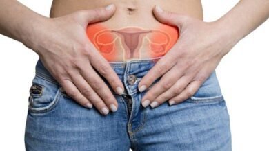 9 sinais de cisto no ovário que a maioria desconhece