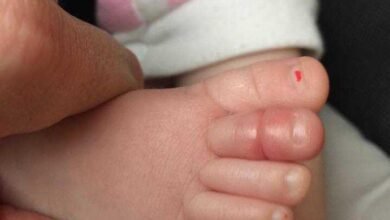 Esta bebê não parava de chorar. Foi então que seus pais viram ISTO no seu dedo do pé. Todos precisam saber desse perigo!